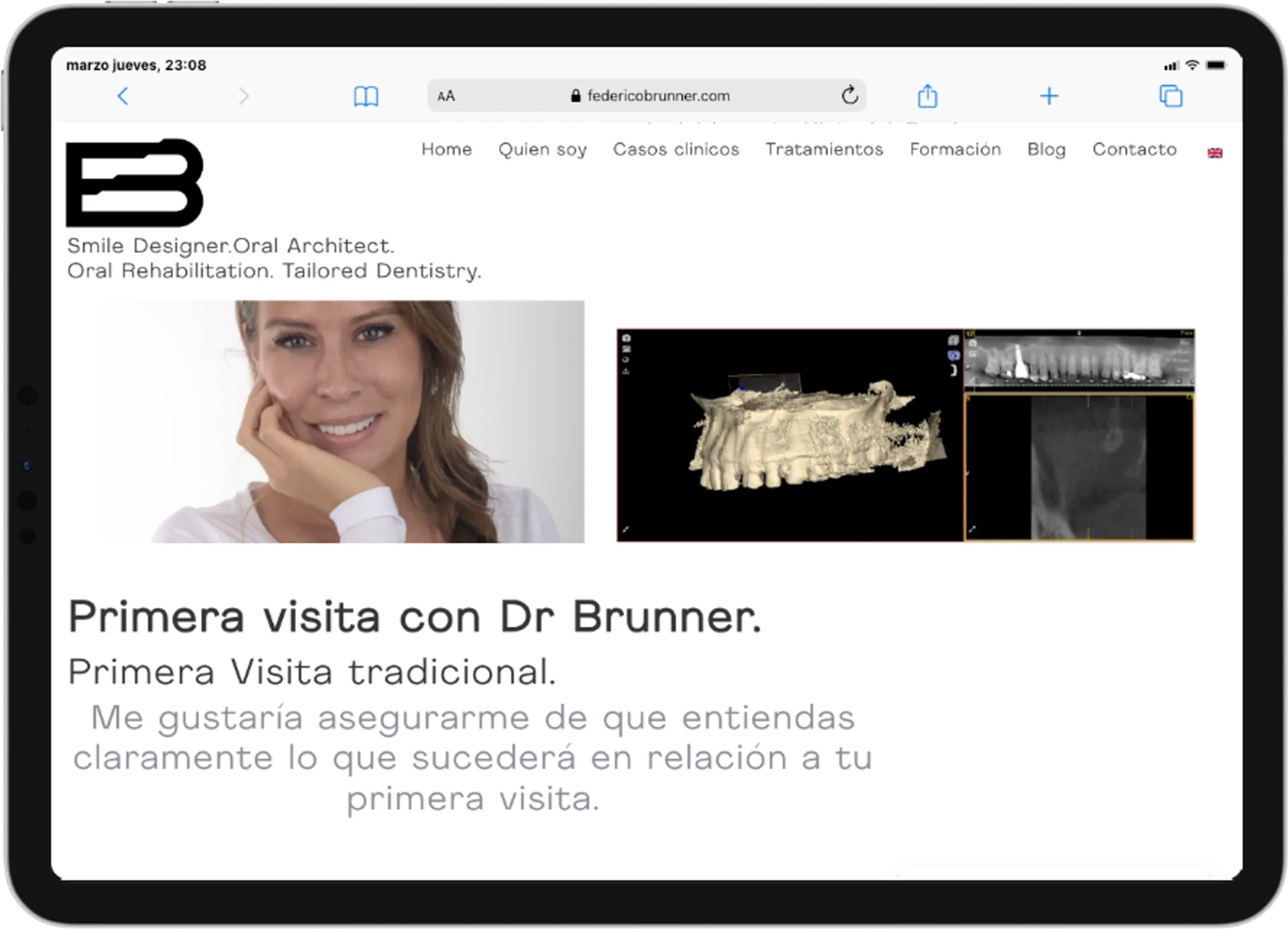 Federico Brunner - imagen 1